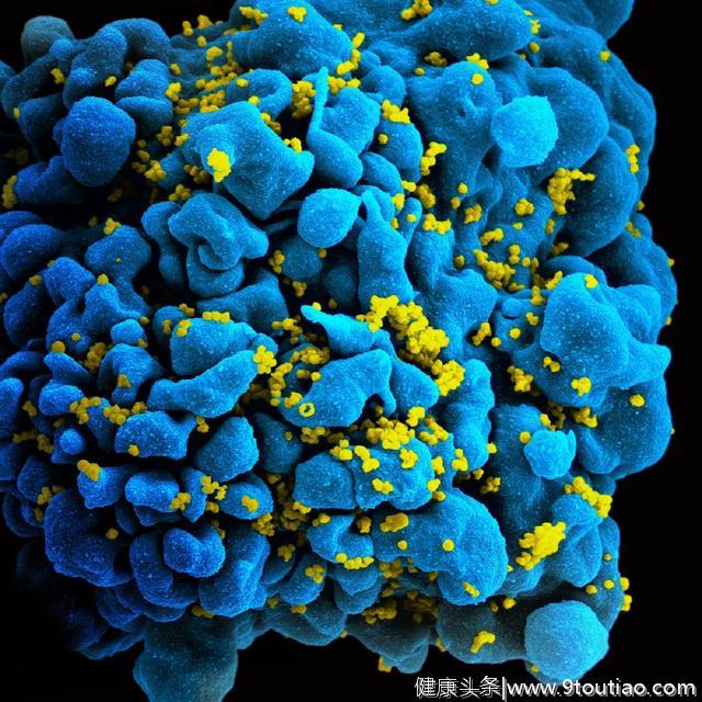 研究表明，免疫治疗药物在治疗患有癌症的艾滋病毒携带者是安全的