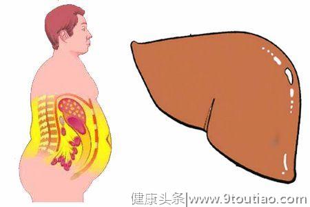 脂肪肝是如何形成的？发现脂肪肝应及时检查，尽早治疗