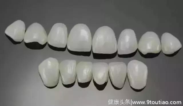 Helen齿科中心——微创，效果又持久的牙齿美容方式——全瓷贴面