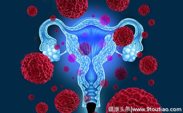 女人要注意：阴道出现这种“难堪”的变化，小心宫颈癌
