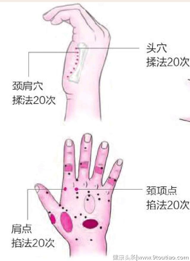 颈椎病在手掌和面部的体现