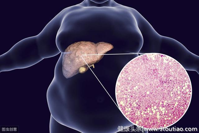 19%中小学生肥胖，其中有一半都有脂肪肝，我们该怎么办？