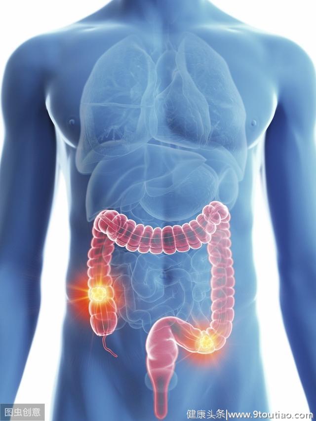 胃同时生长两种肿瘤---胃癌合并胃间质瘤，该如何治疗
