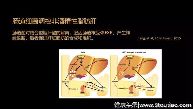 贾伟：肝病肠治？且看肠道细菌如何对肝病推波助澜