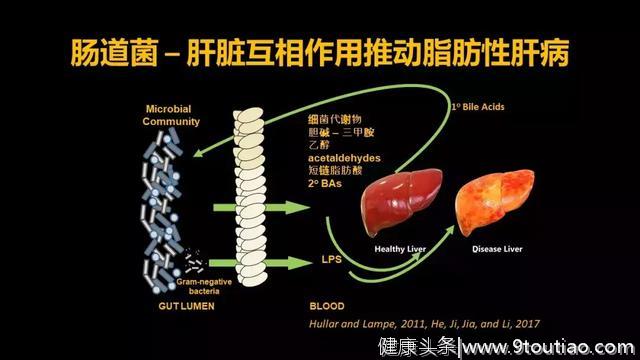 贾伟：肝病肠治？且看肠道细菌如何对肝病推波助澜