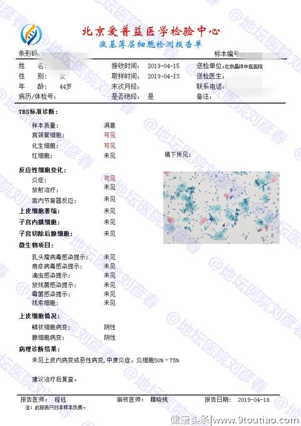 「病例分享」宫颈癌、宫颈病变典型症状大解析，女性自测必看篇