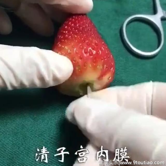 看看这颗“受伤”的草莓，就知道“人流”对女性子宫伤害有多大