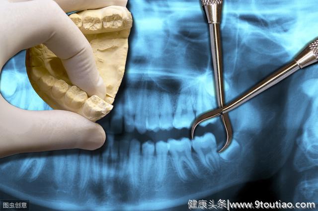 口腔专家良心告诫：这些情况绝对不能拔牙，否则会致命