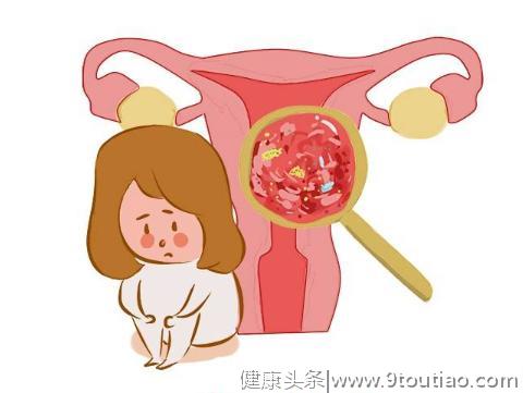 女性子宫受损后，来大姨妈时会出现3个症状，需重视，及时调理