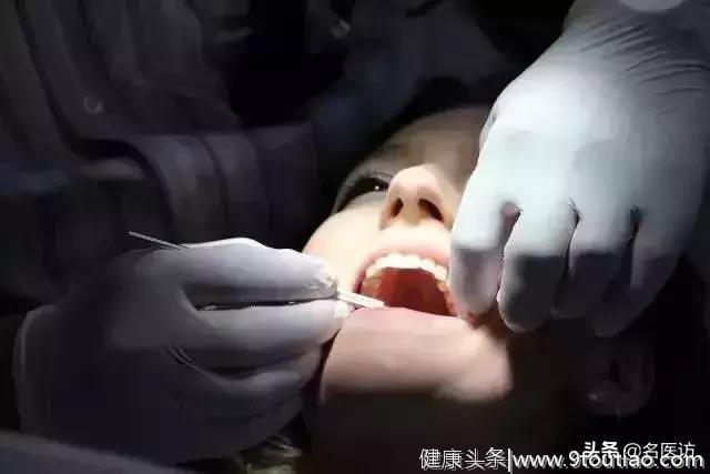 洗牙真的会导致牙缝变宽牙齿松动吗？牙医告诉你真相