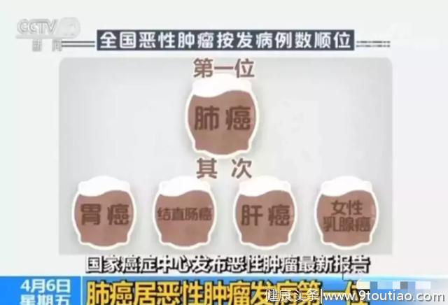 肠癌手术不留切口？在这里可以常规做到！