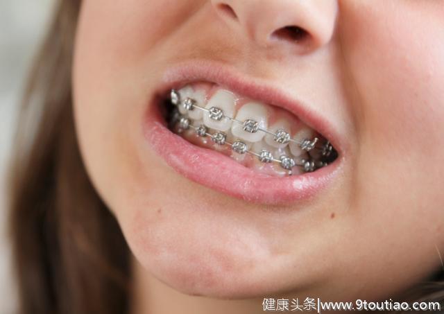 孩子换牙齿，新牙却长歪了怎么办？儿科牙医：这个年龄前不要紧