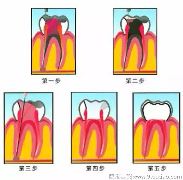 让你秒懂牙科，分分钟解锁牙齿新姿势