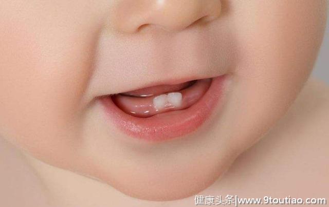 牙医推荐：健康牙齿的5大秘诀，别让牙丑影响孩子面容