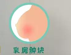 小心！乳腺癌居然和月经有关系