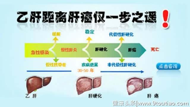 除了酒精，还有6种原因会导致肝硬化，最后一种已被消灭