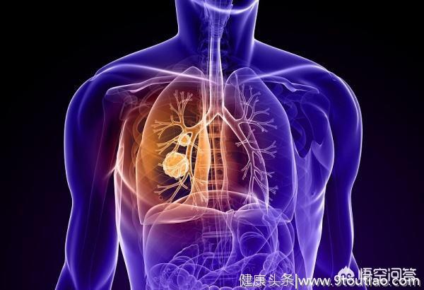 早期肺癌治愈率到底有多高，可以说基本上都可以达到手术根治