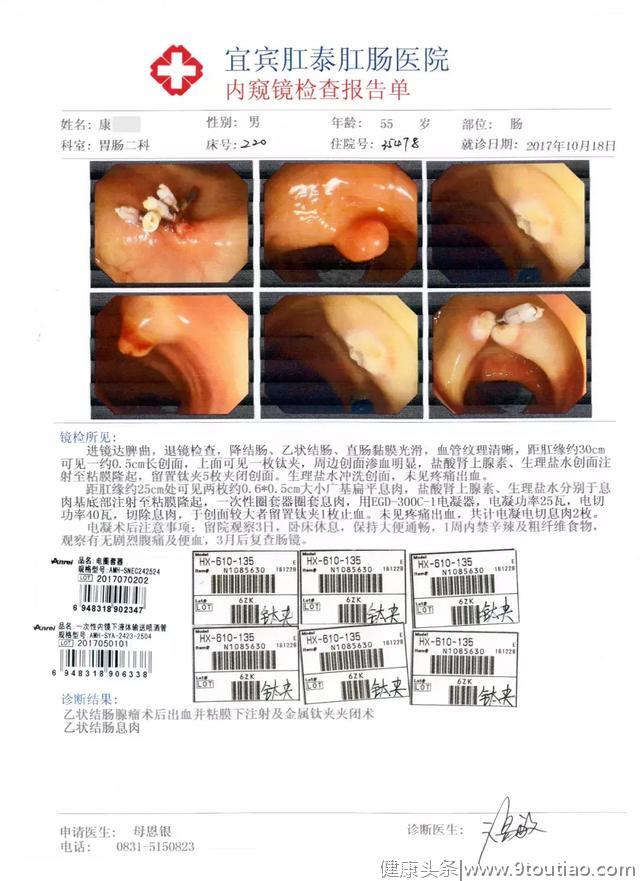 庆幸！宜宾男子只因听了医生的这句话！与肠癌擦身而过