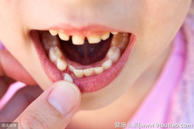 5岁孩子龋齿率高达70%，毁掉牙齿的不是甜食和饮料，是它们