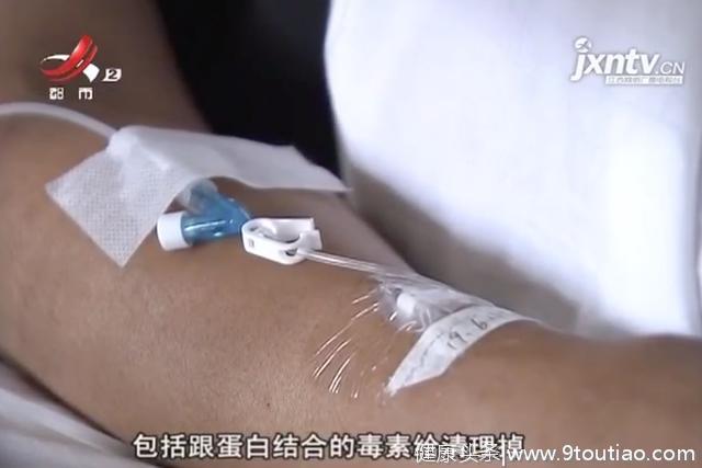 男子误食毒蘑菇导致肝脏衰竭 幸亏及时就医清理体内毒素