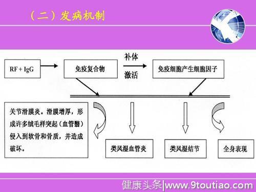 得了类风湿关节炎千万不要忽视，缓解治疗可以降低80%心血管风险