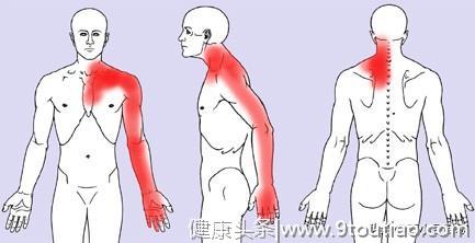 10个白领9个有颈椎问题！别忽视，颈椎病正在要你的命