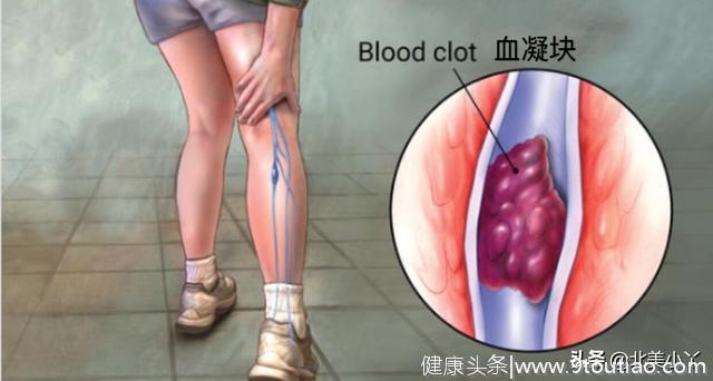 注意15种常见病可以引起腿疼