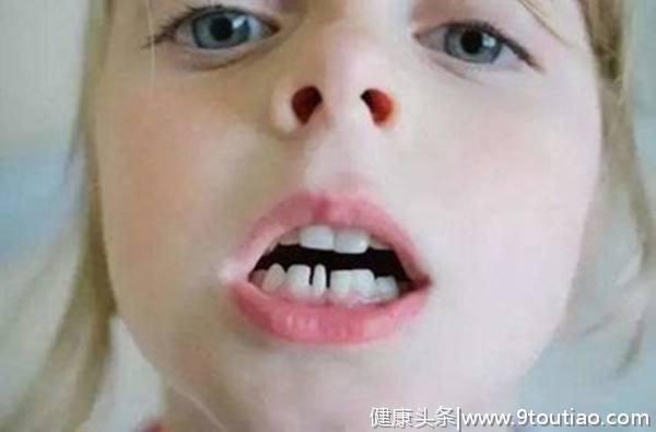 涨姿势！小孩牙齿不齐会有哪些后果？预防矫正别错过三个阶段