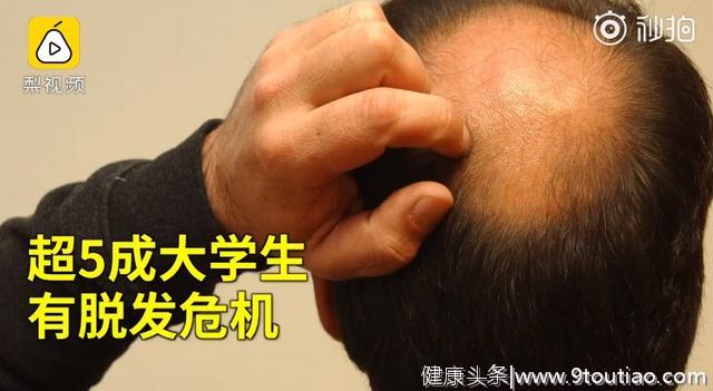 中国人脱发年龄提前20年！央视推荐的生发乌发方，拯救你的头发