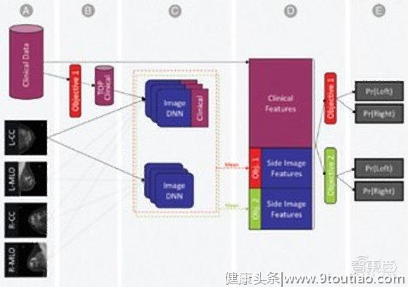 IBM发布最新AI模型！可预测一年内恶性乳腺癌转化概率