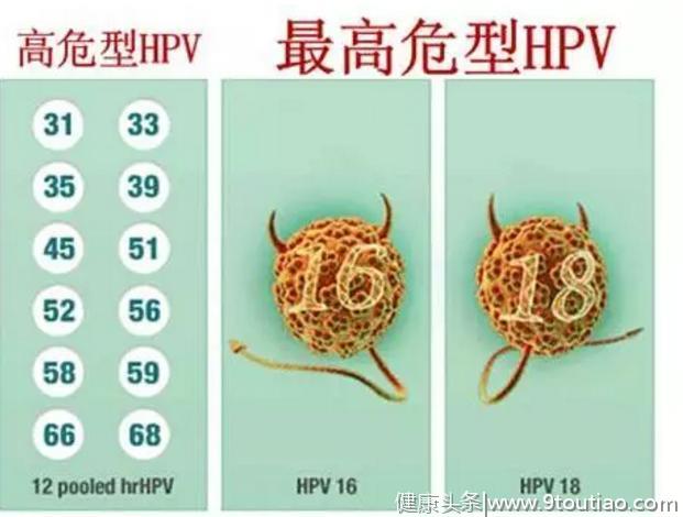 如果不是HPV疫苗面世，全球每一分钟就会有一个女性确诊宫颈癌