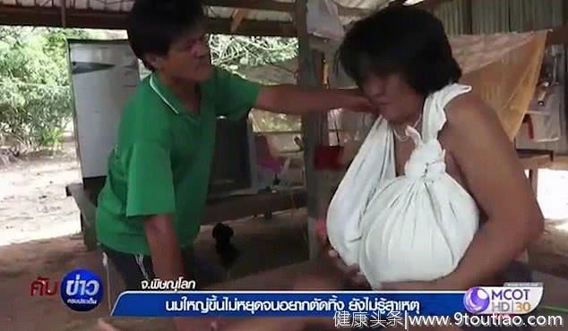 泰国女子患罕见疾病胸部无法停止生长！如今要靠拐杖走路