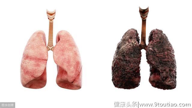 肺癌，多是被“气”出来的，医生：四肢有3种变化，多半肺已受伤