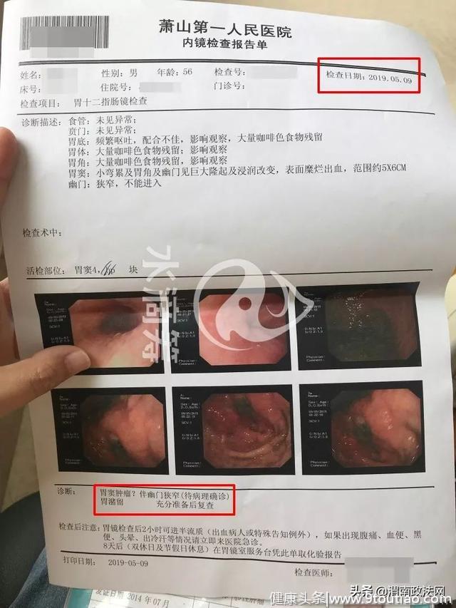 杭州一女子替父筹款20万元称确诊胃癌，几天后炫富被发现