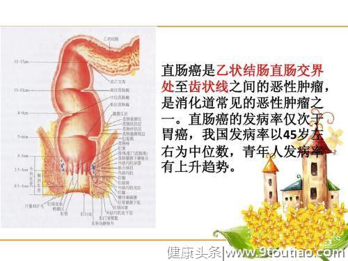 怎么降低肠癌风险？研究发现只要每周吃两次以上这种食物就有效