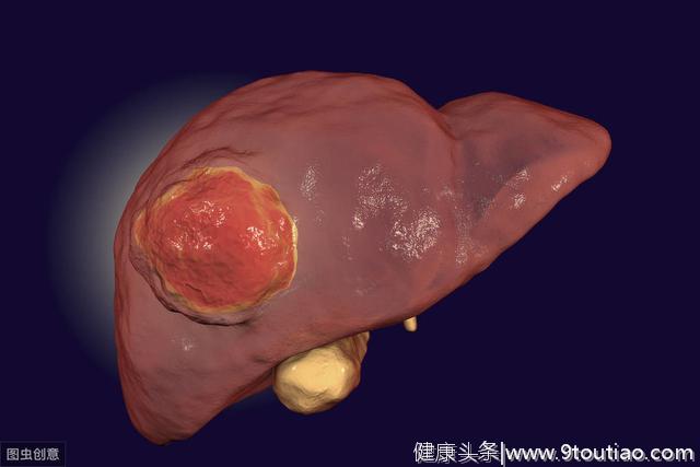 肝癌多是"拖"出来的，手部出现5个异常，或许是肝脏在求救