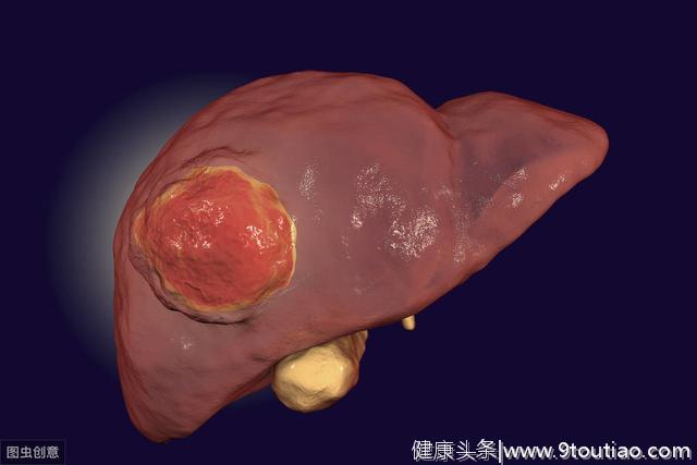 这是肝癌的“高压线”，千万不要碰，家里有的赶紧扔掉