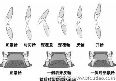 Helen齿科中心——成年人还能否矫正？