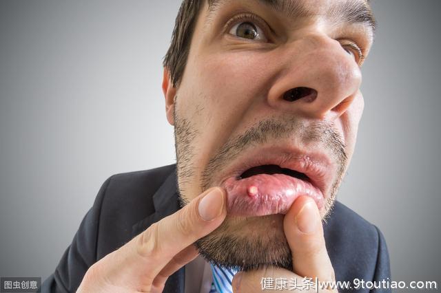 为什么有些人经常患口腔溃疡，而有些人从来没有口腔溃疡？