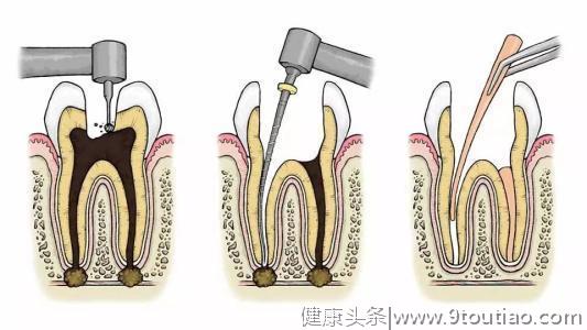 觉得看牙太贵，心疼钱包？其实这些钱是可以省下来的