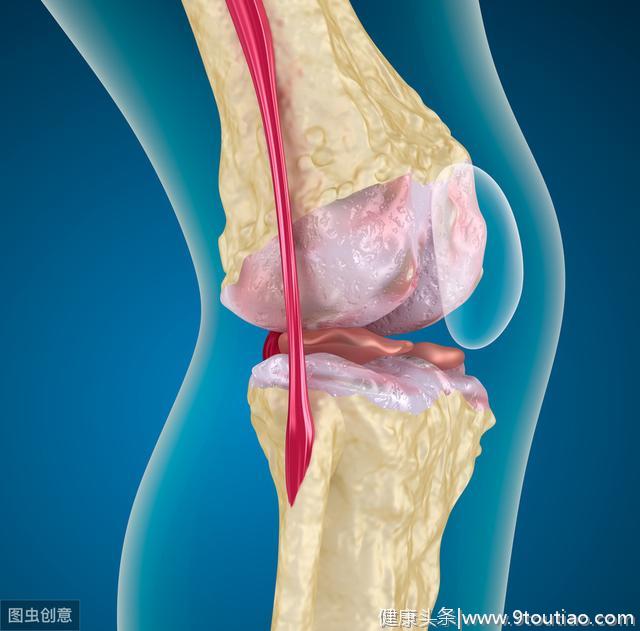 膝关节炎采用注射疗法有用吗？来看看医学界的统一认识