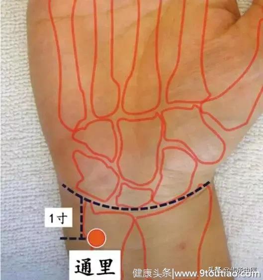 针灸22奇穴（建议收藏）