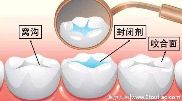 史上最全牙齿指南，一次性解决从出生到成年的所有牙齿问题