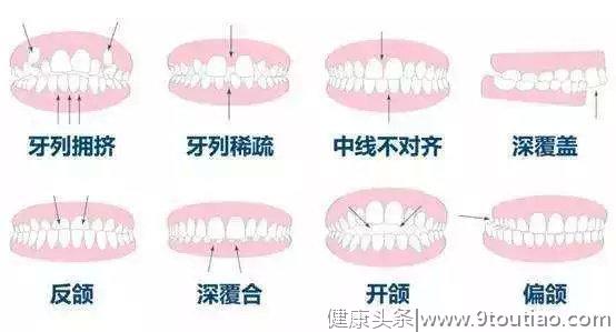 史上最全牙齿指南，一次性解决从出生到成年的所有牙齿问题