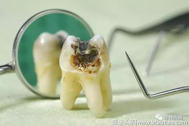 牙齿上有小黑点到失去牙齿要几步？
