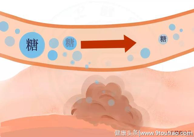 各国防癌、增强抵抗力各有高招！不看不知道，一看真有效