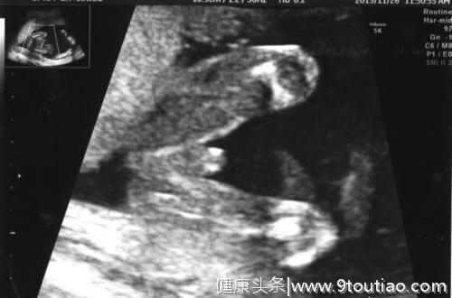 怀孕1~9个月，通过B超看胎儿慢慢长大的样子，真是太神奇了