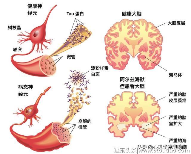 我们都想努力的过好生活，但总是有一些“小意外”