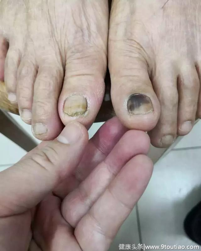 王新民中医专栏 | 下肢游走性疼痛是何病？