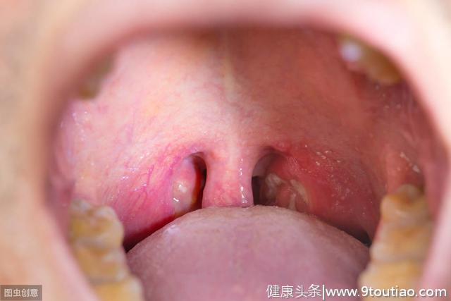 张嘴有口臭，可能不是口腔有问题，而是这6种疾病在报警，快看看
